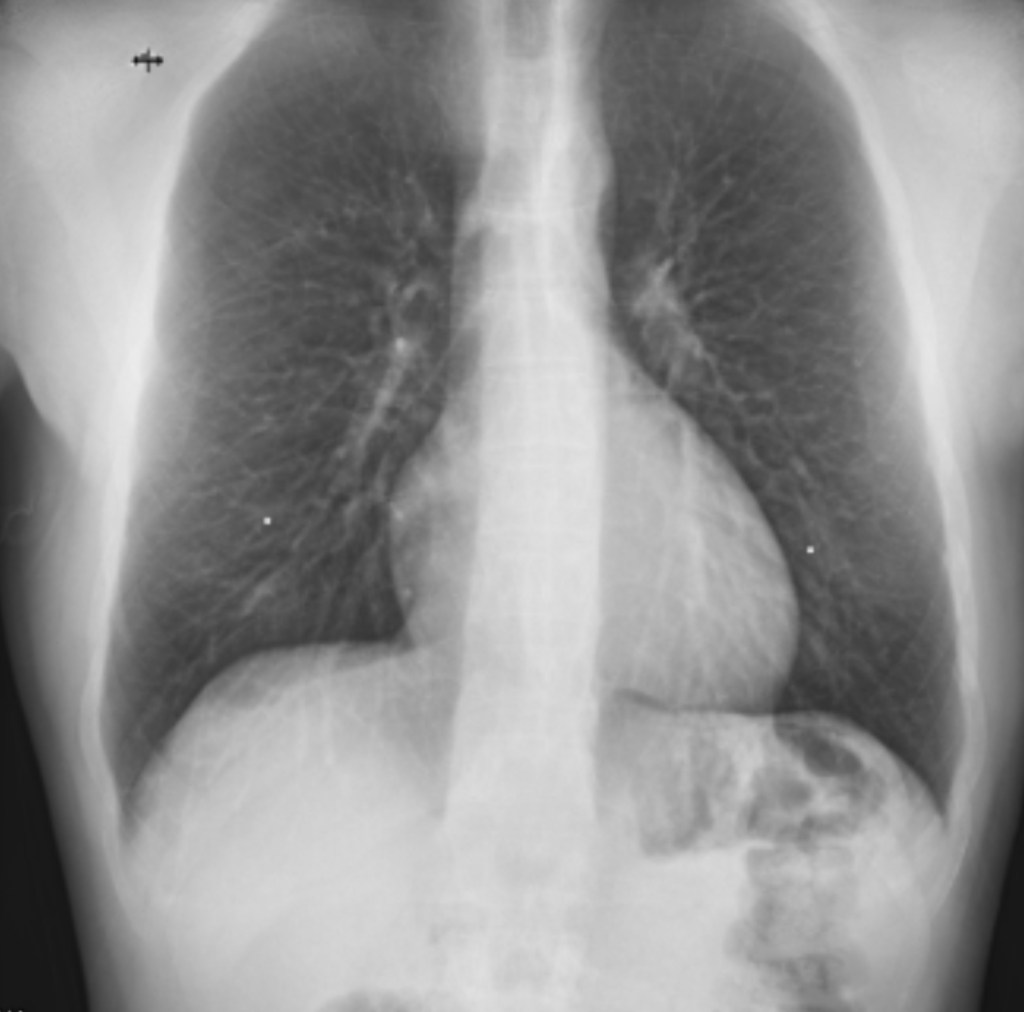 X-ray scan from January 2025