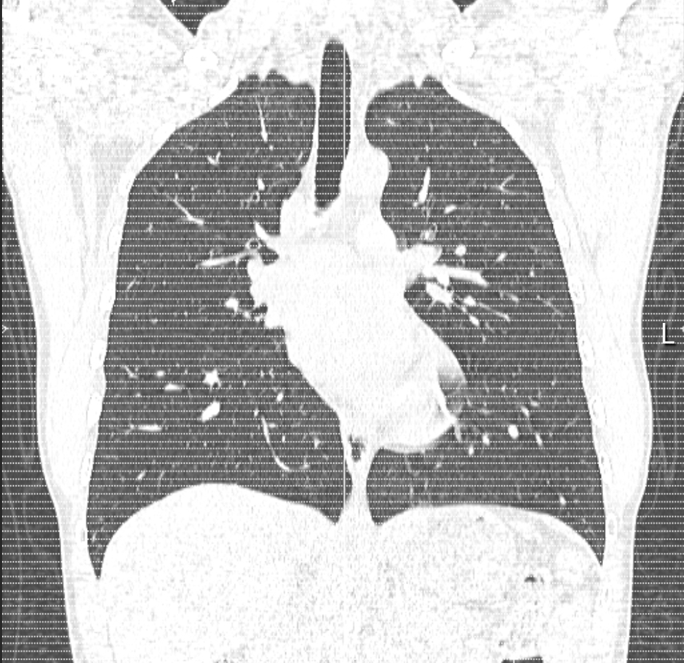 CT scan from February 2025