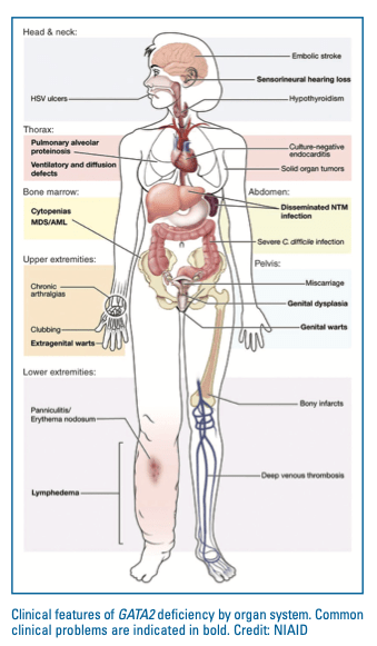 GATA2 deficiency clinical problems by organ system