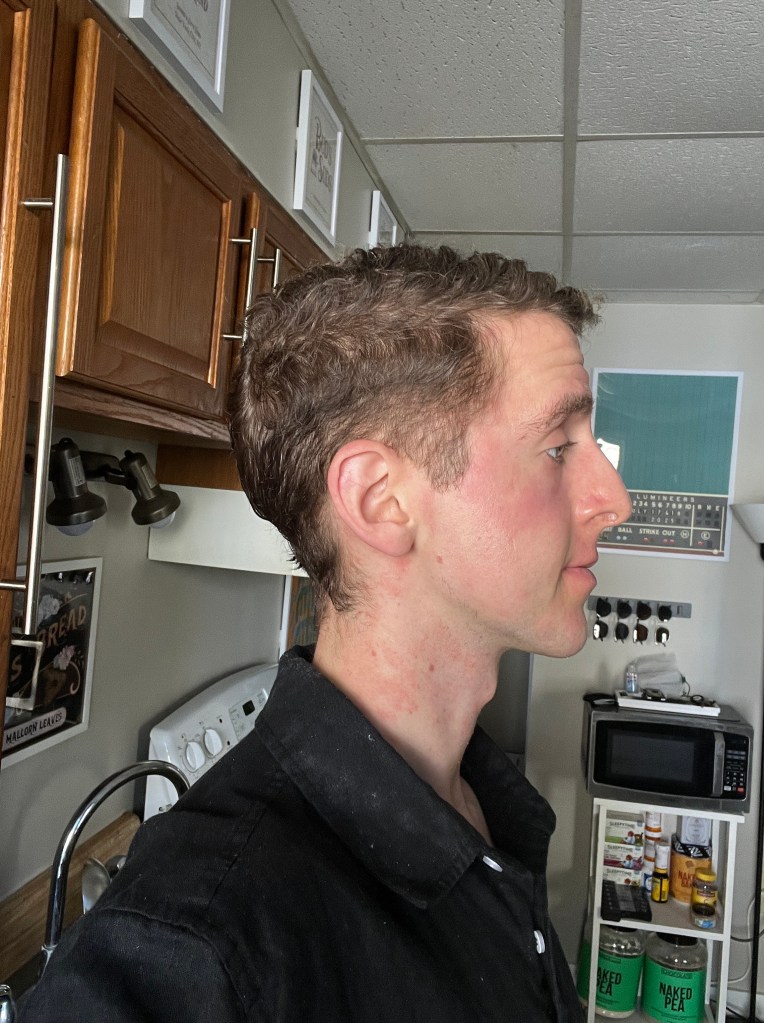 Day +300 hair photo