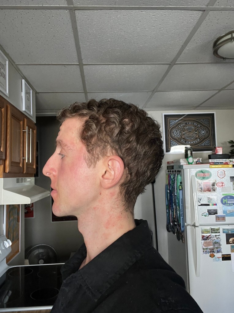 Day +300 hair photo